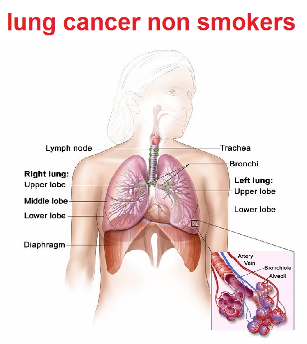 Lungs Of A Smoker