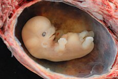 Miscarriage At 6 Weeks Images