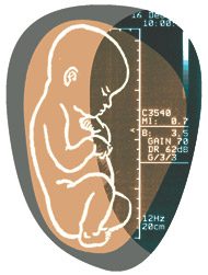 Miscarriage At 6 Weeks Painful