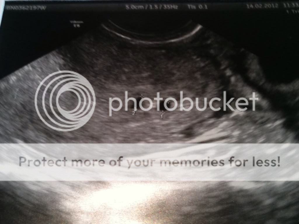 Miscarriage At 7 Weeks Pictures