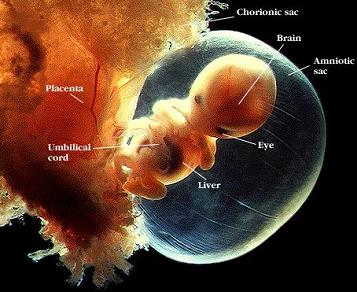 Miscarriage At 8 Weeks