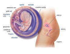 Miscarriage Bleeding