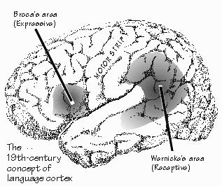 Mri Frontal Lobe Damage