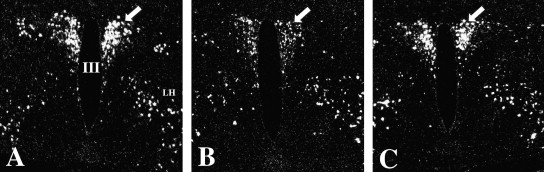 Negative Feedback Inhibition Occurs When Trh