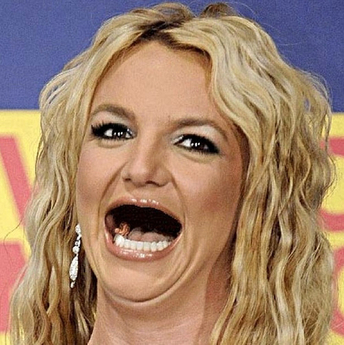 Pictures Of Celebs Without Teeth