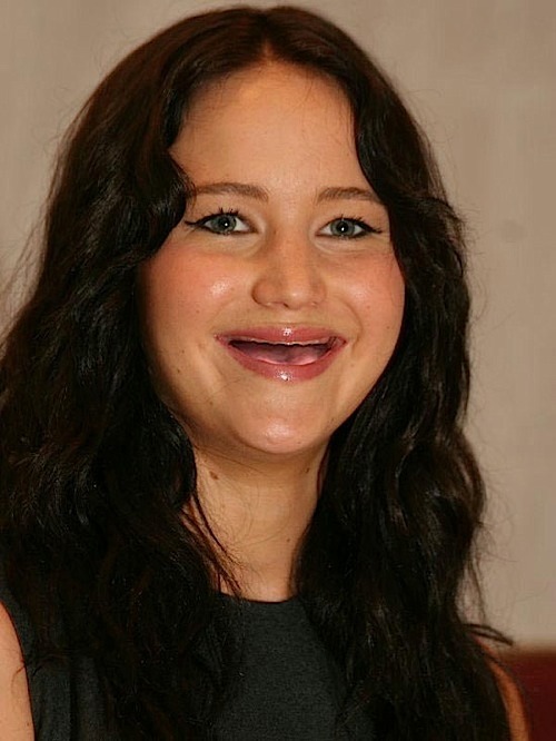 Pictures Of Celebs Without Teeth