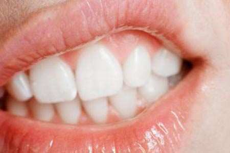 Pictures Of Healthy Gums And Teeth