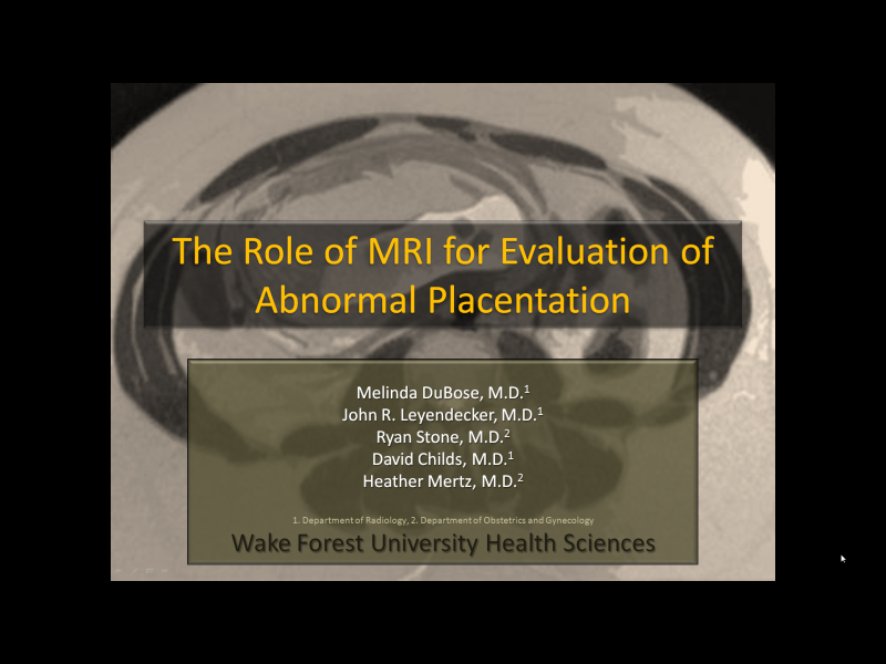 Placenta Accreta Mri Protocol