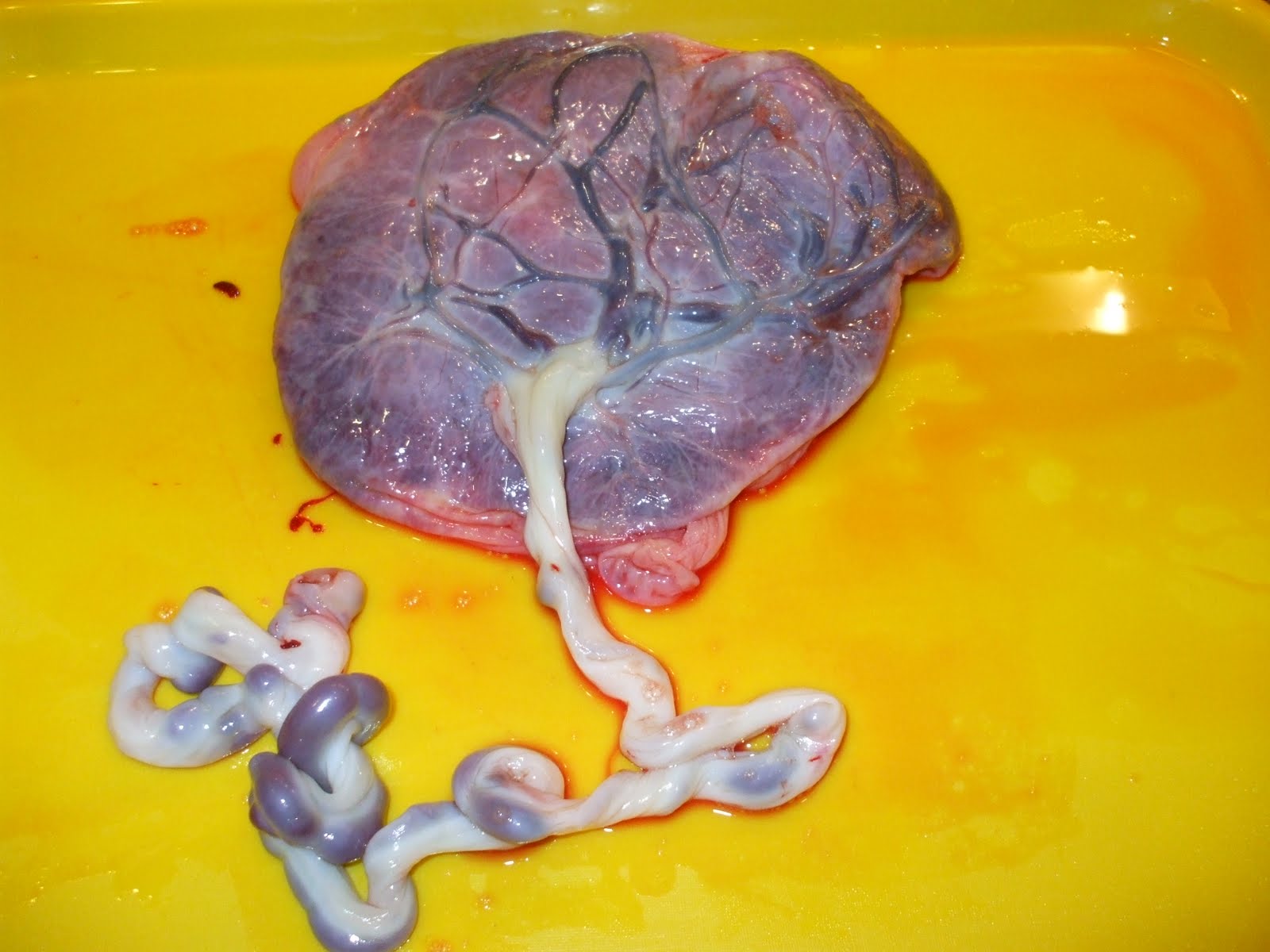 Placenta After Birth