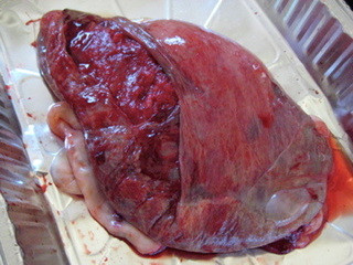 Placenta After Birth