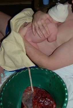 Placenta After Birth