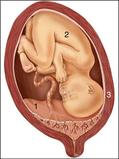 Placenta Previa Marginal Pdf