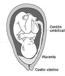 Placenta Previa Marginal Pdf