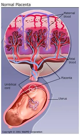 Placenta Previa Marginal Pdf