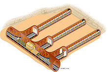 Plutonium Battery Pacemaker