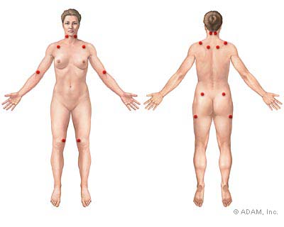 Pressure Points In Hands For Headaches