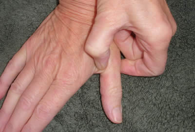 Pressure Points In Hands For Headaches