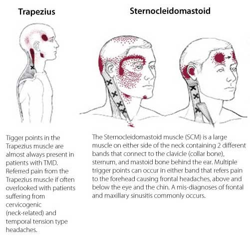 Pressure Points In Hands For Headaches