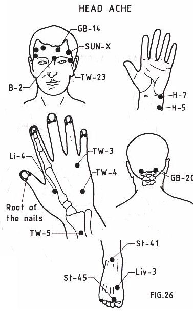 Pressure Points On Head For Headaches