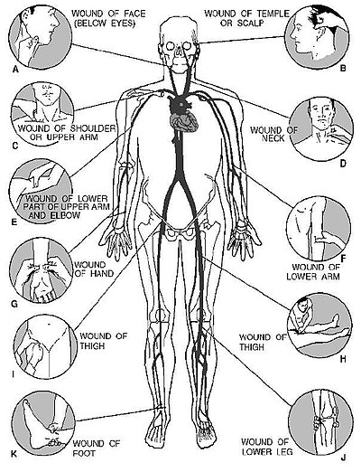 Pressure Points Self Defense Diagram