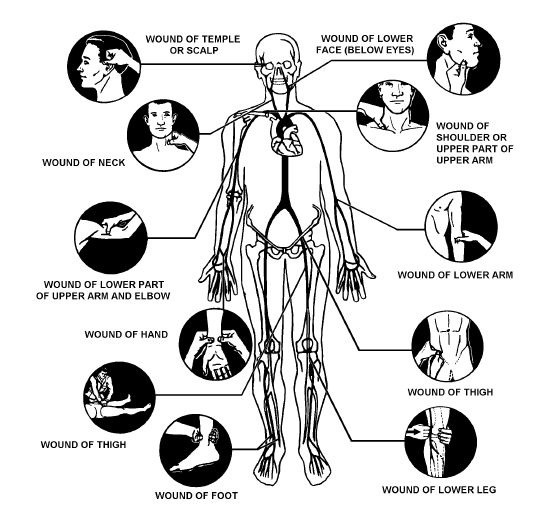 Pressure Points Self Defense Diagram