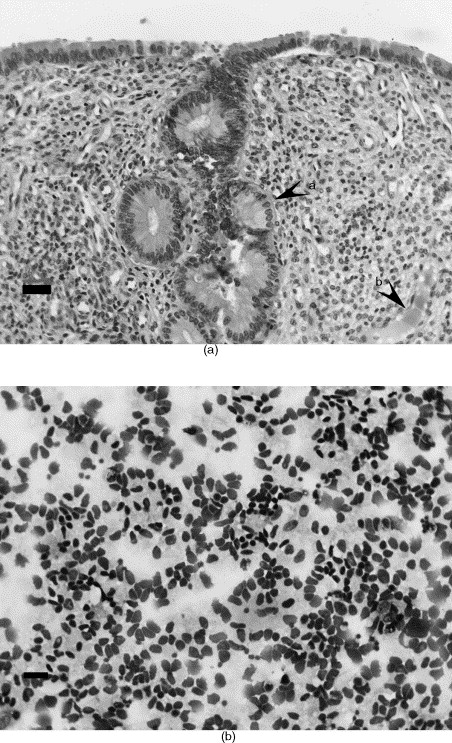 Products Of Conception Histology