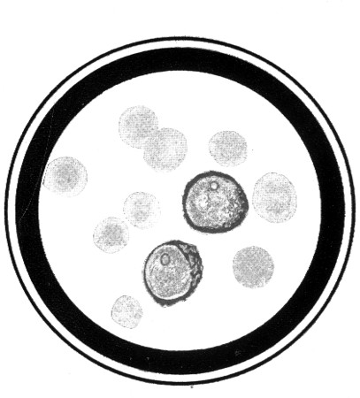 Products Of Conception Histology