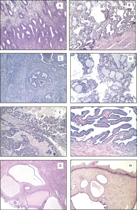 Products Of Conception Histology