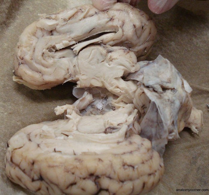 Sheep Brain Diagram Unlabeled