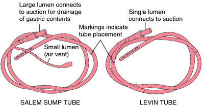 Types Of Feeding Tubes For Cats