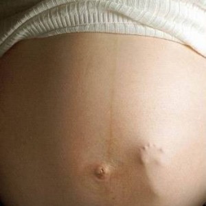 What Does A Miscarriage At 6 Weeks Look Like