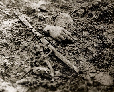 World War 1 Pictures Dead Soldiers